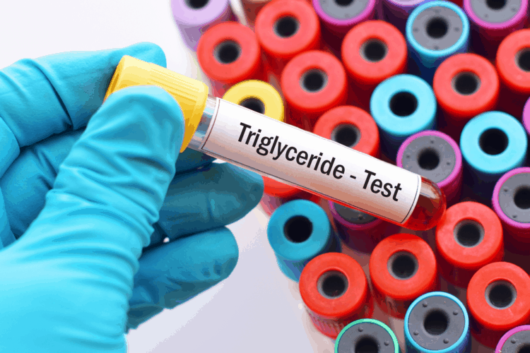 Nguyên nhân làm tăng triglyceride triglyceride