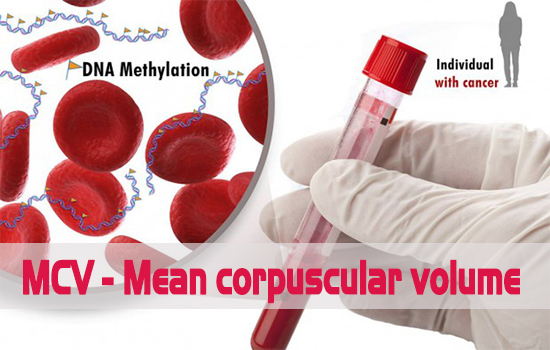 Chỉ số xét nghiệm MCV và những điều cần biết