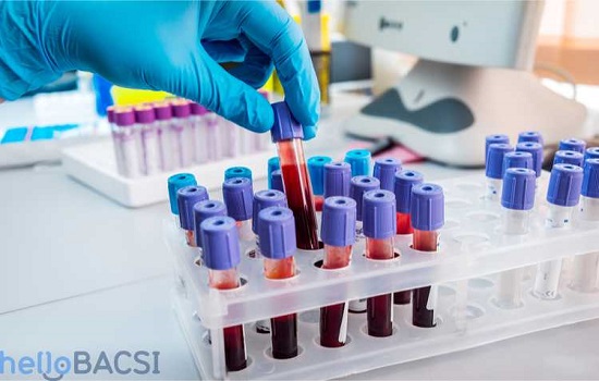 Giải mã ý nghĩa của các chỉ số xét nghiệm máu