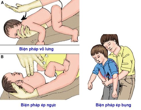 be-37-thang-nuot-phai-dong-xu-bo-me-can-hoc-ngay-cach-xo-cuu