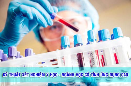 điều kiện học cao đẳng x&eacute;t nghiệm
