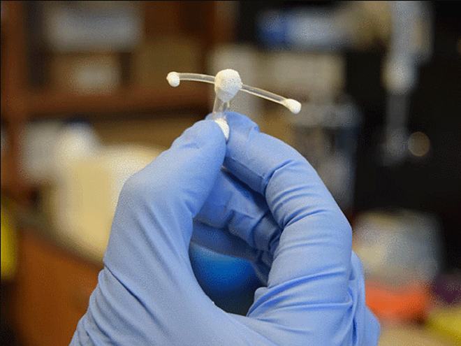 Thiết bị được cấy ghép trong âm đạo ngừa HIV cho phụ nữ