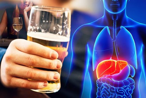 Uống bia rượu là tác nhân gây ra các bệnh lý về gan