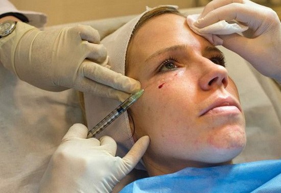 Phương pháp “Mặt nạ ma cà rồng” dùng 25 đầu kim nhỏ để đưa huyết tương vào toàn bộ da mặt của khách hàng và khiến da mặt rỉ máu.